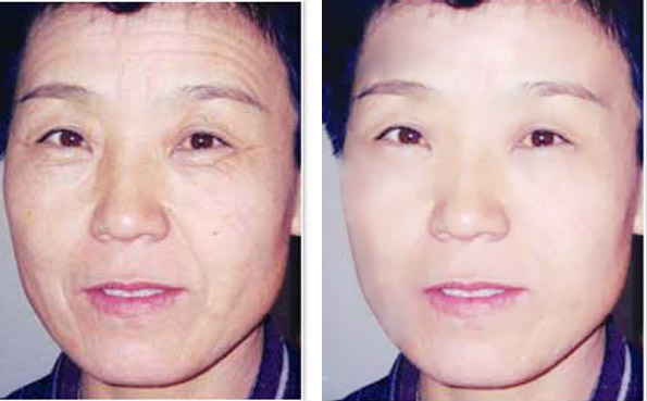 美容效果的<em>前后对比图片</em>-<em>图片</em>编辑-猪八戒网